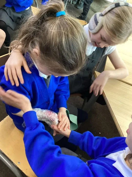 Y3 burns and scalds2