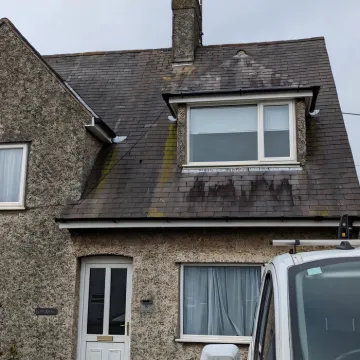 Fascia 4 &ndash; Before 2