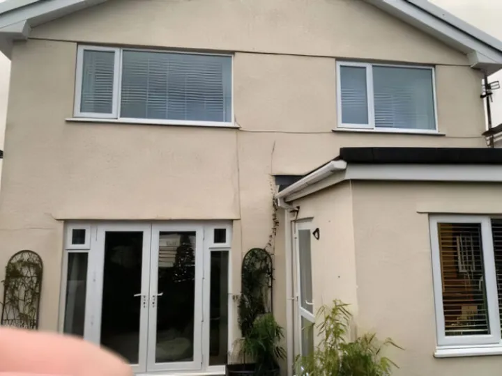 Fascia 1 &ndash; Before